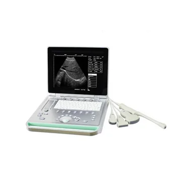 Медицинские Инструменты UItrasound для ноутбука, ультразвуковой аппарат, Ч/Б Портативный ультразвуковой сканер